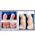 Lova Skin Instant Foot Peeling Neceser